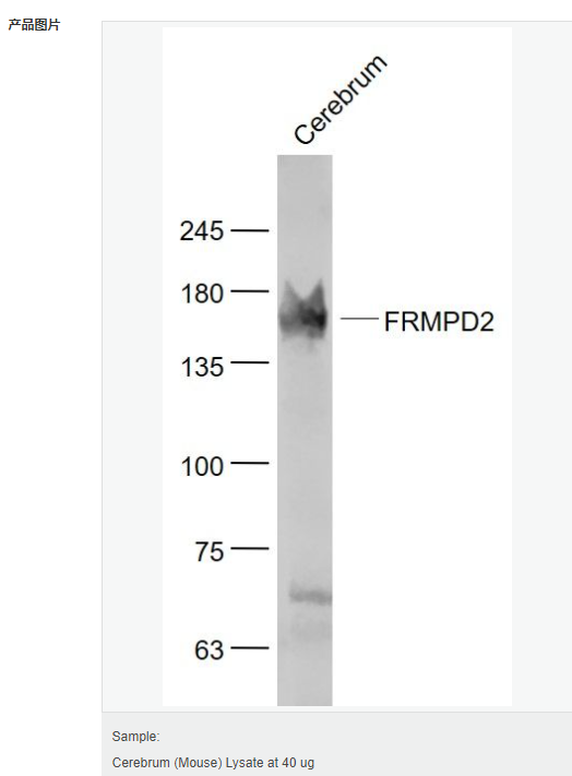 6054445466ce7.png image.png