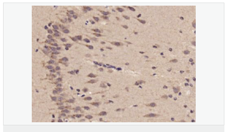 6057eed3dfc59.png image.png