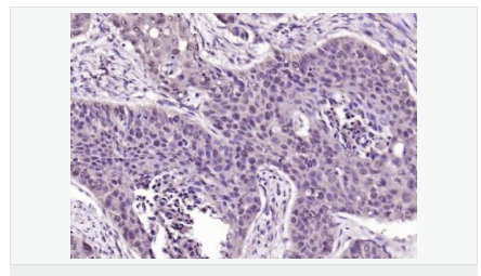 60584c6ee3d9f.png image.png