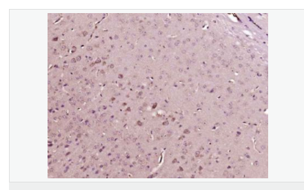 6058509a053de.png image.png