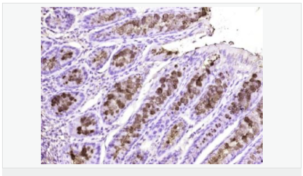 60594348b2b9b.png image.png