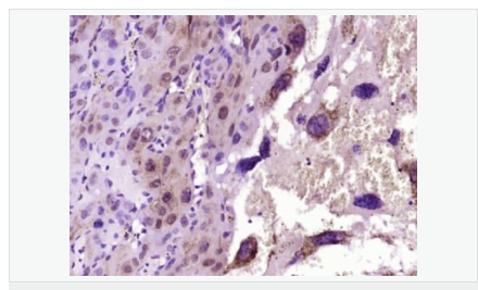 6059a62ebb6ed.png image.png