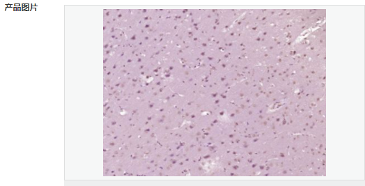 6059a90767568.png image.png