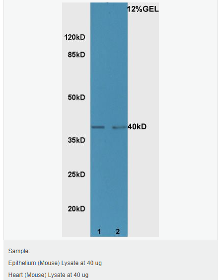 605d890b394e2.png image.png