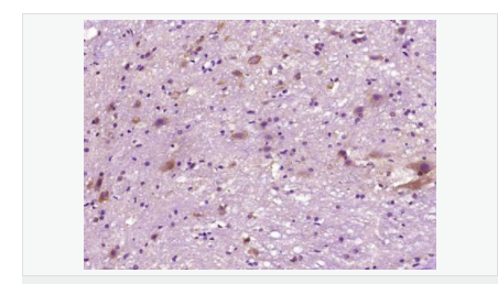 605da18189225.png image.png