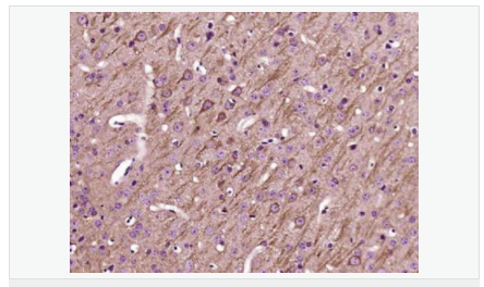 606bccb51305e.png image.png