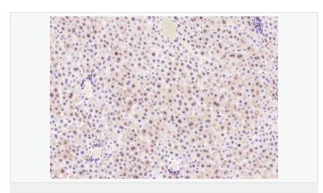 606bd485c1325.png image.png