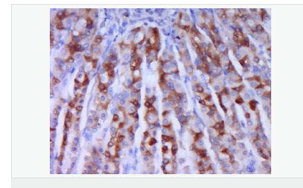 6076564045bf5.png image.png