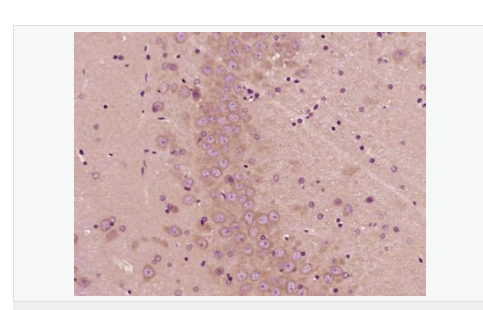 6076872fc5d0c.png image.png