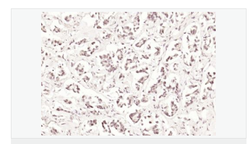 6077fa2845bc8.png image.png